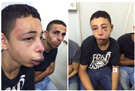 Israeli Police Brutally Beat Palestinian-American Youth