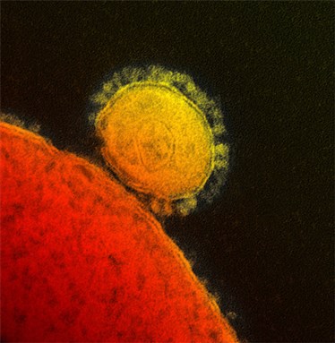 [Electron micrograph image of the MERS coronavirus, which has killed over 165 people worldwide since first being identified in 2012. Image from NIH/Wikimedia Commons]
