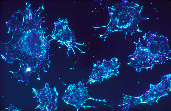[Cancer cells. Source: Wikimedia Commons]